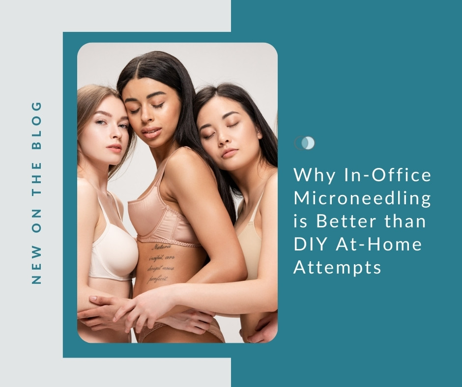 Why In-Office Microneedling is Better than DIY | Palo Alto Laser